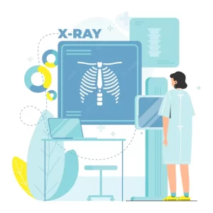 Digital X-ray